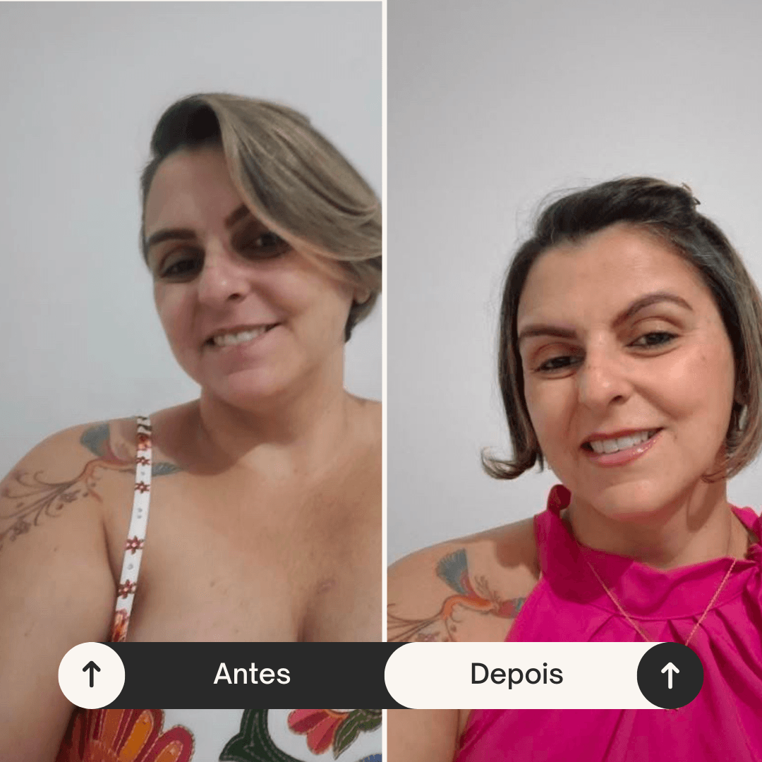 Resultado Protocolo Vita — antes e depois